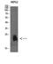 Plasminogen Receptor With A C-Terminal Lysine antibody, A13829, Boster Biological Technology, Western Blot image 