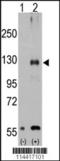 Transient Receptor Potential Cation Channel Subfamily M Member 8 antibody, TA302225, Origene, Western Blot image 
