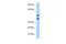 Homeobox A13 antibody, PA5-40459, Invitrogen Antibodies, Western Blot image 