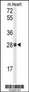 Tetraspanin 1 antibody, 63-594, ProSci, Western Blot image 
