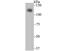 Melanoma Cell Adhesion Molecule antibody, NBP2-80441, Novus Biologicals, Western Blot image 