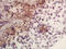 AT-rich interactive domain-containing protein 1B antibody, GTX60275, GeneTex, Immunohistochemistry paraffin image 