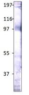 Stimulated By Retinoic Acid 6 antibody, GTX47857, GeneTex, Western Blot image 
