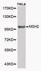 MutS Homolog 2 antibody, MBS125501, MyBioSource, Western Blot image 