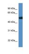 Tigger Transposable Element Derived 4 antibody, orb325791, Biorbyt, Western Blot image 
