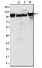 MutS Homolog 2 antibody, AM06094SU-N, Origene, Western Blot image 