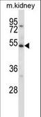 Unc-51 Like Kinase 3 antibody, LS-C160429, Lifespan Biosciences, Western Blot image 