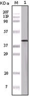 Ovalbumin antibody, STJ98294, St John