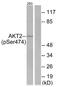 Alpha-2-Glycoprotein 1, Zinc-Binding antibody, orb221983, Biorbyt, Western Blot image 