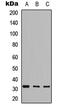 Glutamate-Cysteine Ligase Modifier Subunit antibody, abx121482, Abbexa, Western Blot image 