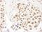 FA Complementation Group D2 antibody, IHC-00624, Bethyl Labs, Immunohistochemistry frozen image 