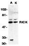 Receptor Interacting Serine/Threonine Kinase 2 antibody, orb74357, Biorbyt, Western Blot image 