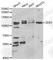 Zinc Finger E-Box Binding Homeobox 1 antibody, A5600, ABclonal Technology, Western Blot image 