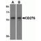 CD276 Molecule antibody, TA355034, Origene, Western Blot image 
