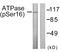 ATPase Na+/K+ Transporting Subunit Alpha 1 antibody, LS-C198653, Lifespan Biosciences, Western Blot image 