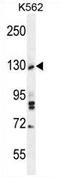 Tau Tubulin Kinase 2 antibody, AP54392PU-N, Origene, Western Blot image 