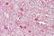 Activating Transcription Factor 1 antibody, 28-895, ProSci, Immunohistochemistry paraffin image 