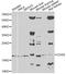 CD59 Molecule (CD59 Blood Group) antibody, A1689, ABclonal Technology, Western Blot image 