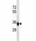 Epithelial Cell Adhesion Molecule antibody, F46203-0.4ML, NSJ Bioreagents, Western Blot image 