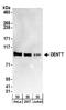 Testis-specific Y-encoded-like protein 2 antibody, A304-013A, Bethyl Labs, Western Blot image 