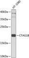 Cancer/Testis Antigen 1B antibody, 23-915, ProSci, Western Blot image 