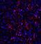 Calcium release-activated calcium channel protein 1 antibody, M00909, Boster Biological Technology, Immunofluorescence image 