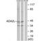 Transcriptional Adaptor 2A antibody, A08832, Boster Biological Technology, Western Blot image 