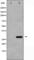 Cyclin Dependent Kinase Inhibitor 1B antibody, abx011964, Abbexa, Western Blot image 