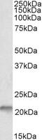 Replication Timing Regulatory Factor 1 antibody, 43-054, ProSci, Immunofluorescence image 