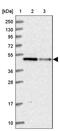 IST1 Factor Associated With ESCRT-III antibody, PA5-59738, Invitrogen Antibodies, Western Blot image 