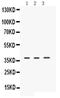 Endogenous Retrovirus Group W Member 1, Envelope antibody, PA5-79220, Invitrogen Antibodies, Western Blot image 