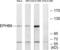 EPH Receptor B6 antibody, LS-B7665, Lifespan Biosciences, Western Blot image 