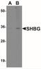 Sex hormone-binding globulin antibody, NBP2-41294, Novus Biologicals, Western Blot image 