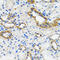 Component Of Inhibitor Of Nuclear Factor Kappa B Kinase Complex antibody, 18-473, ProSci, Immunohistochemistry paraffin image 