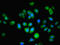 N-Acetyltransferase 2 antibody, orb355799, Biorbyt, Immunofluorescence image 