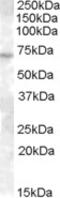 ATP Binding Cassette Subfamily C Member 11 antibody, 46-868, ProSci, Enzyme Linked Immunosorbent Assay image 