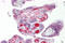 Solute Carrier Family 26 Member 4 antibody, ARP41739_P050, Aviva Systems Biology, Immunohistochemistry frozen image 
