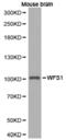 Wolframin ER Transmembrane Glycoprotein antibody, LS-C192933, Lifespan Biosciences, Western Blot image 