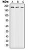 DNA Polymerase Alpha 1, Catalytic Subunit antibody, LS-C352673, Lifespan Biosciences, Western Blot image 