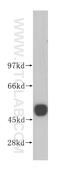 Ubiquinol-Cytochrome C Reductase Core Protein 2 antibody, 14742-1-AP, Proteintech Group, Western Blot image 