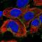 Folate transporter 1 antibody, NBP1-83430, Novus Biologicals, Immunocytochemistry image 