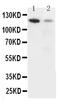 Integrin Subunit Alpha 3 antibody, PA5-79528, Invitrogen Antibodies, Western Blot image 