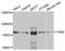 TGF-Beta Activated Kinase 1 (MAP3K7) Binding Protein 2 antibody, STJ111909, St John