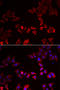 LIM Zinc Finger Domain Containing 1 antibody, STJ28467, St John