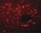 Sequestosome 1 antibody, PA5-20839, Invitrogen Antibodies, Immunofluorescence image 