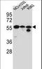 Forkhead Box N2 antibody, LS-C166235, Lifespan Biosciences, Western Blot image 