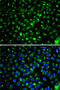 Cytochrome P450 Family 2 Subfamily E Member 1 antibody, 18-545, ProSci, Immunofluorescence image 