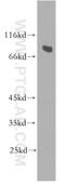 URI1 Prefoldin Like Chaperone antibody, 11277-1-AP, Proteintech Group, Western Blot image 