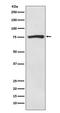 Acyl-CoA Synthetase Short Chain Family Member 2 antibody, M02809, Boster Biological Technology, Western Blot image 