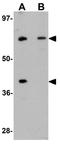 Tectonic Family Member 3 antibody, GTX85175, GeneTex, Western Blot image 